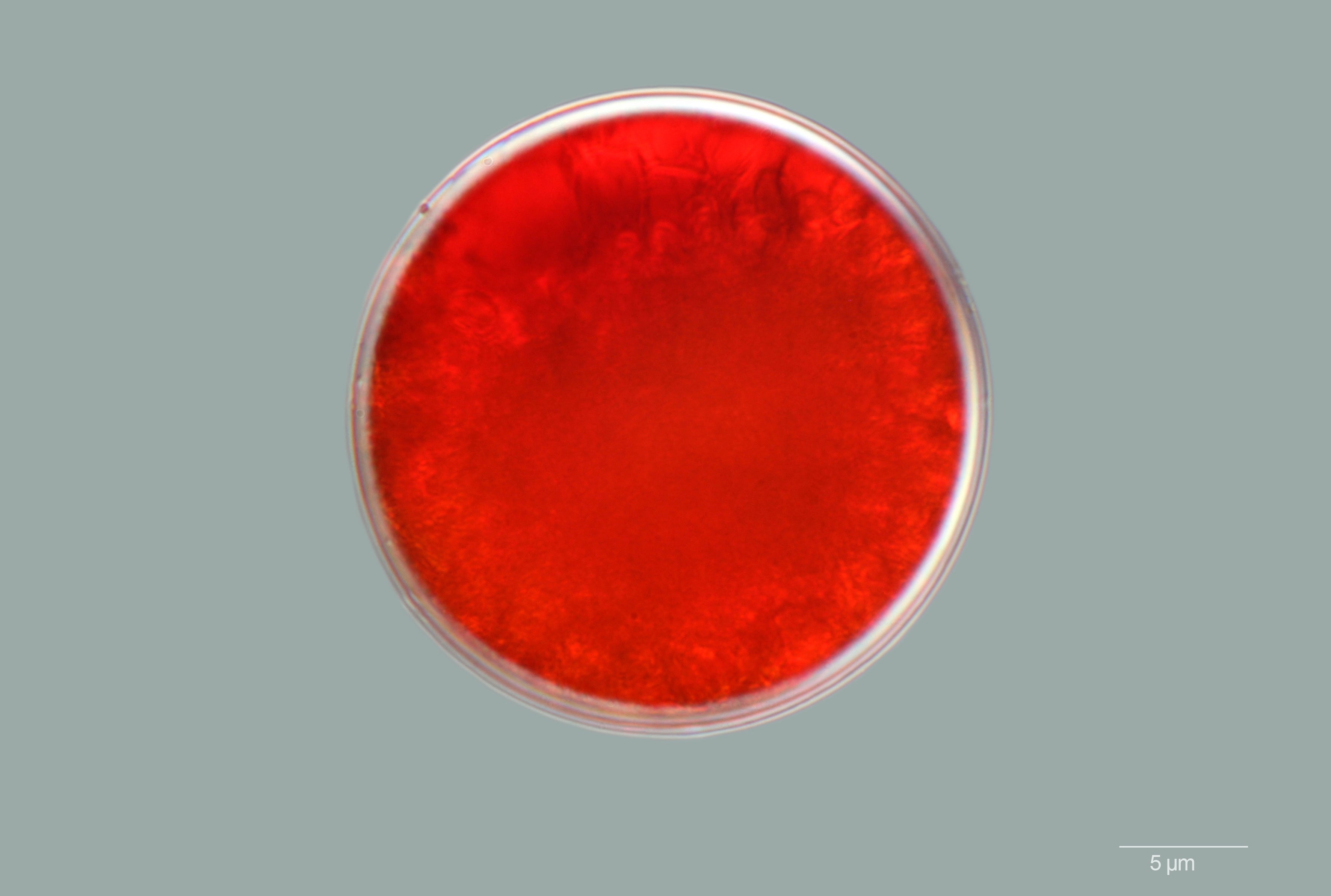 Red Haematococcus pluvialis microalgae associated with astaxanthin